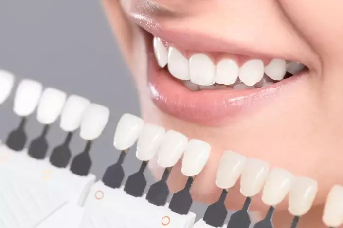 Implantes Dentales: Precio, Tipos, Etapas y Resultados